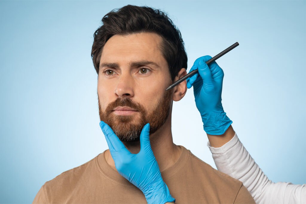 Beard and Mustache Transplant man FINAL