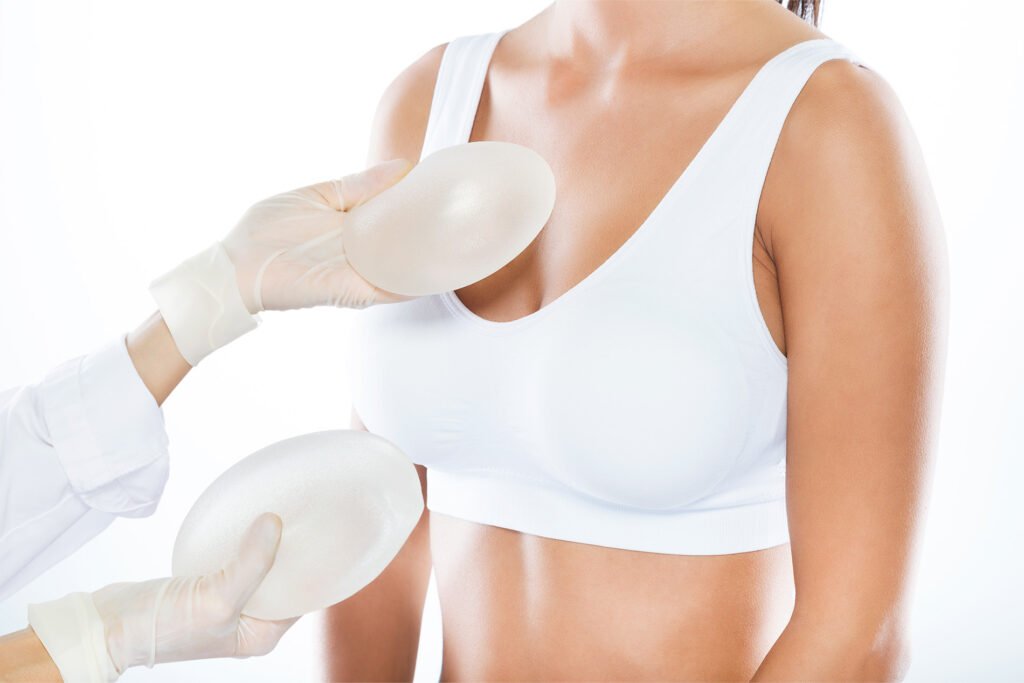 Breast Augmentation final 3