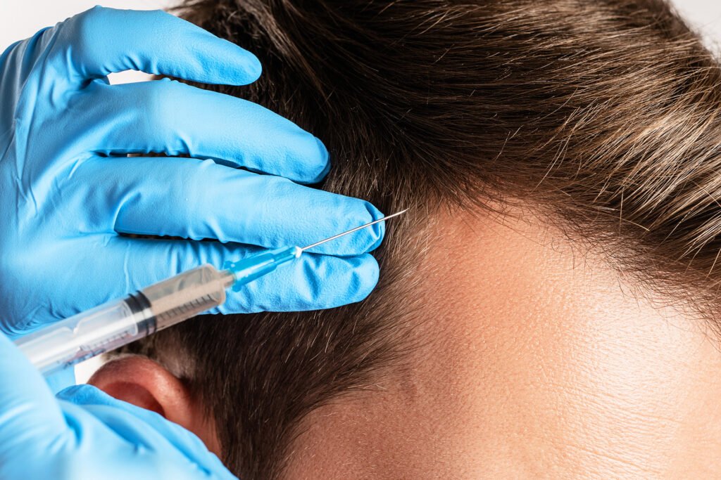 Hair Transplant man FINAL1