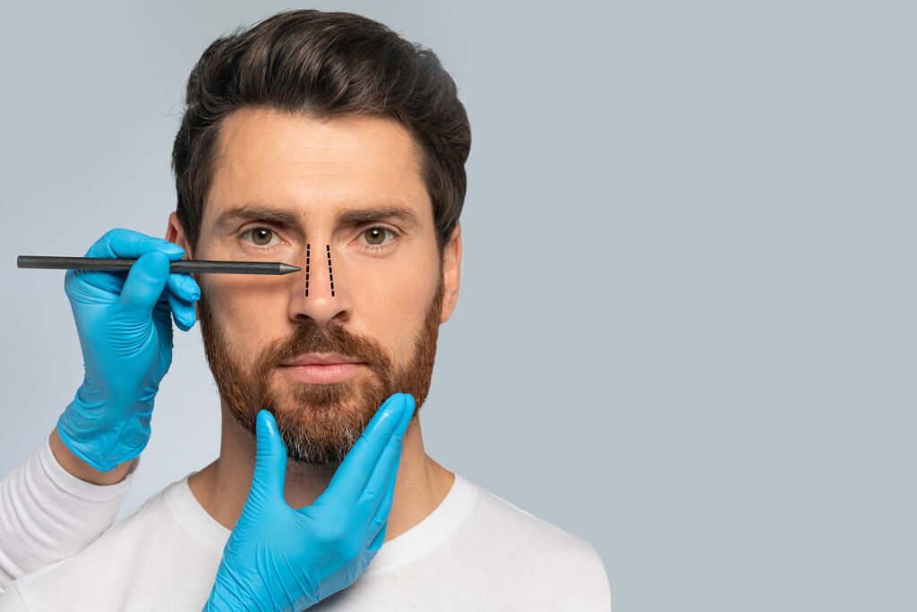 Rhinoplasty MAN FINAL1